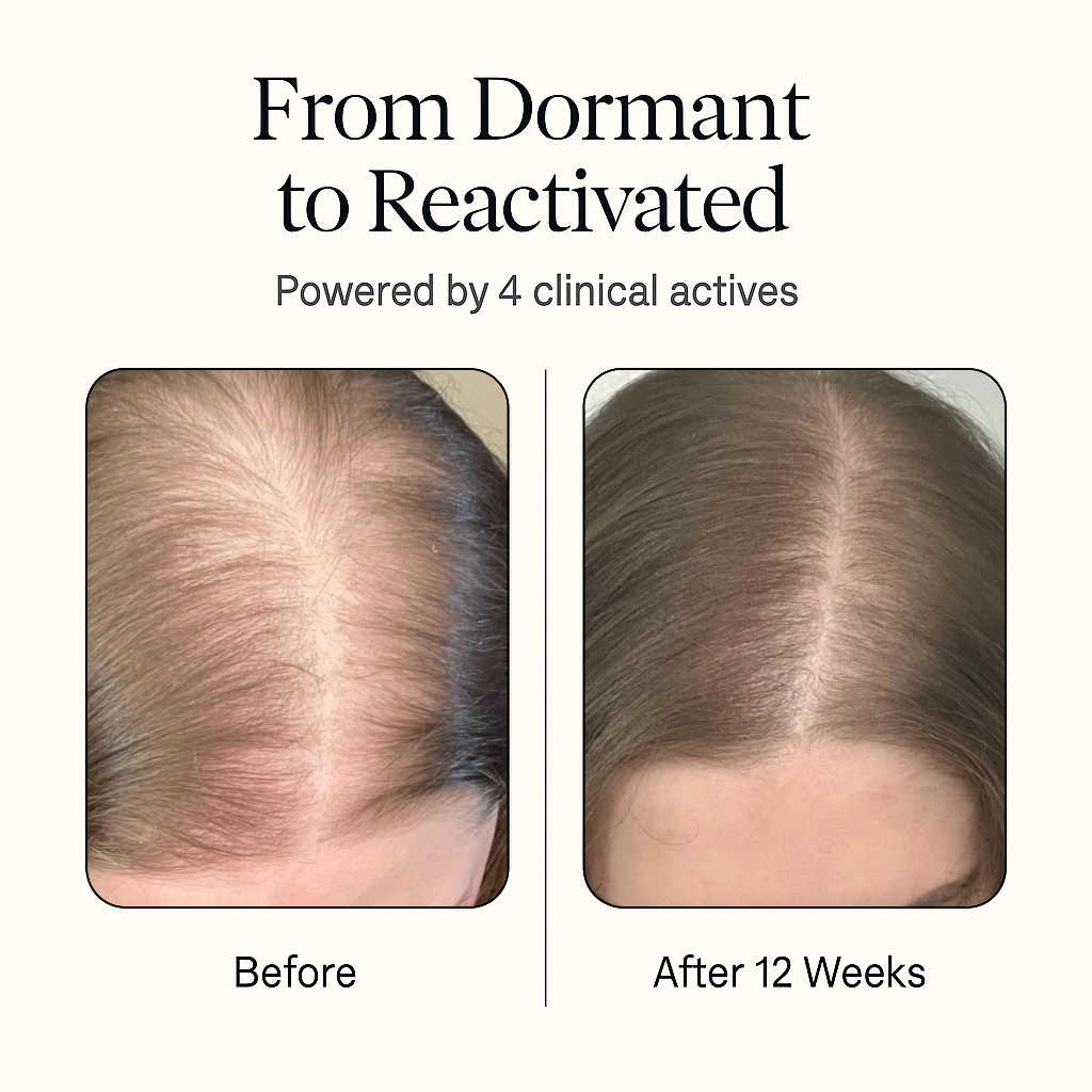 Dethera Root-Reactivator