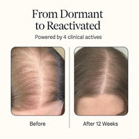 Dethera Root-Reactivator