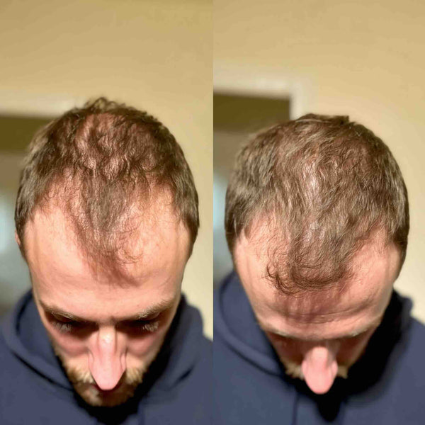 Jake, 37